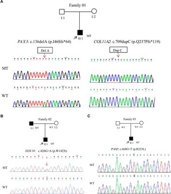 Case report: Exotropia in waardenburg syndrome with novel variations